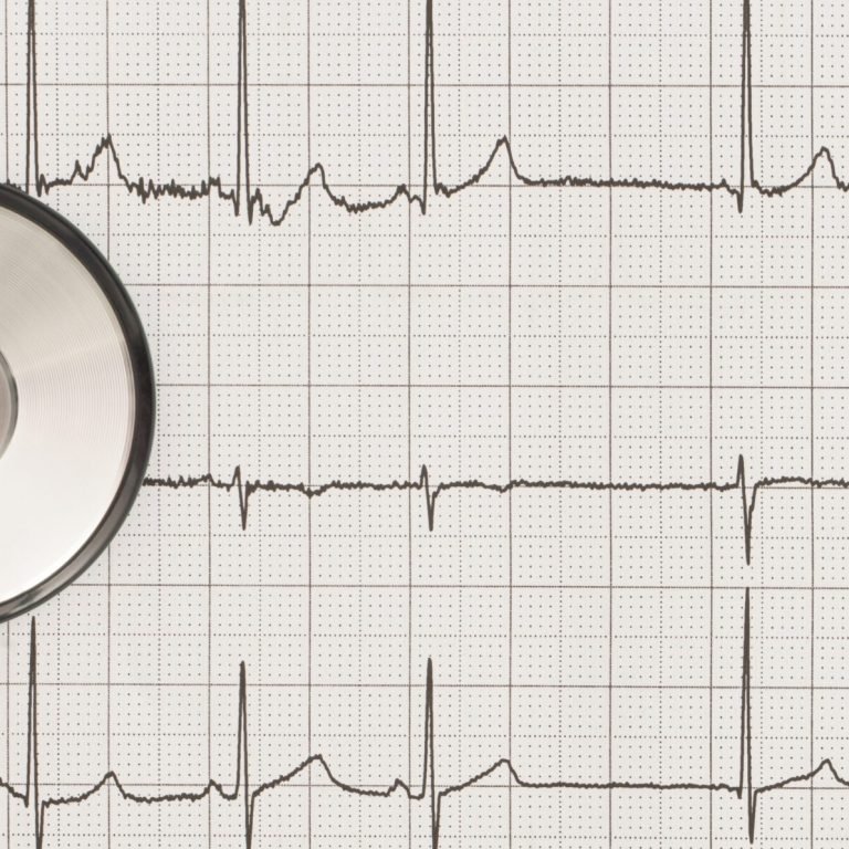 recuperarea-in-afectiuni-cardiovasculare